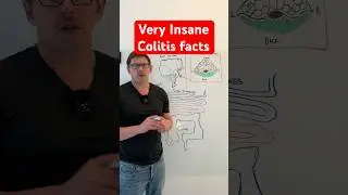 Pan-Colitis - I Bet Your Didn't Know This!