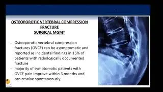 Unstable Osteoporotic Compression Fractures by Robert Ames, MD, on November 23, 2020
