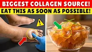 GOODBYE Swelling! 8 Collagen-Rich Foods That Heal Your Legs & Joints FAST
