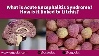 What is Acute Encephalitis Syndrome (AES)? How is AES linked to Litchis? (ORGOS IAS)