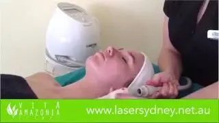 Laser Sydney - Thermavisage Facial Treatment
