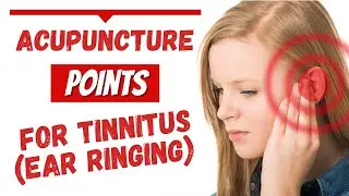 Acupuncture For Tinnitus (Ear Ringing) #acupuncturefortinnitus