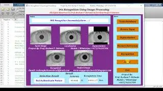 Iris Recognition Using Matlab Project | Iris Recognition Using Machine Learning Matlab Code