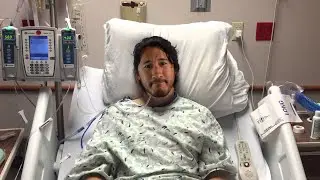 i broke my nose... twice...