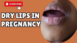 DRY MOUTH / LIPS DURING PREGNANCY 33 WEEKS PREGNANT | CAUSES, SYMPTOMS & REMEDIES