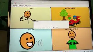 How to use the capture feature on chat editor 