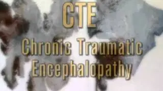 Studying brains to understand TBI
