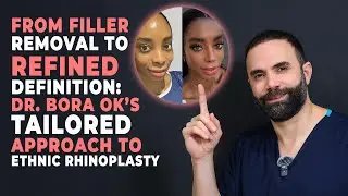 From Filler Removal to Refined Definition: Dr. Bora Ok&rsquo;s Tailored Approach to Ethnic Rhinoplasty