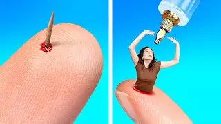 OH NOO! IF SPLINTER WERE A PERSON! Hilarious Relatable Life Moments