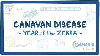 Canavan disease (Year of the Zebra)