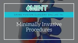Spine Fusion Surgery Dallas TX: Minimally Invasive Procedures &ndash; Dr. Scott Kutz | (972) 244-3491