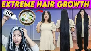 Most Powerful DIY For Hairgrowth 😱 Stop Hairfall Instantly, Remove Dandruff, 3X Hairgrowth SoftHair 