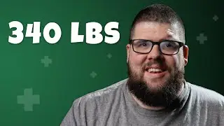 340 Lbs, Diabetes, & Heart Issues: Why This DAD Chose VSG (Male Journey Begins)