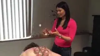Fire Cupping Demonstration with Jennifer Dabu