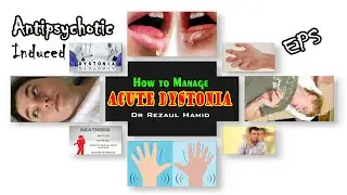 Acute Dystonia - Causes & Management @Dr Rezaul Hamid