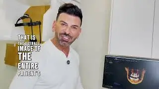 Why CBCT Cone Beam X-Rays are a Game Changer in Dentistry | Dr. Fakhimi Explains