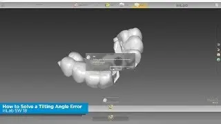 inLab SW 18: How to Solve a Tilting Angle Error - Surgical Guides