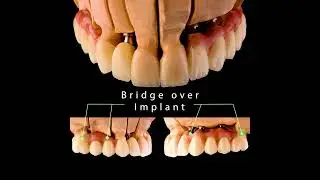 Multidisciplinary Approach in Dentistry