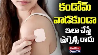 Birth Control Patch Effectiveness, Pros and Cons l Women's Health @MedPlusONETV