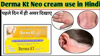 derma KT Neo cream use in Hindi allergy ke liye cream @DrAkeel603 #medicine #skin #chehra #allergy
