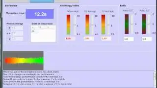 VOCALAB - The MPT tool of the Evaluation Module