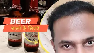Beer Good or Bad for Hair | Alcohol for hair | Arun Hari Transplant