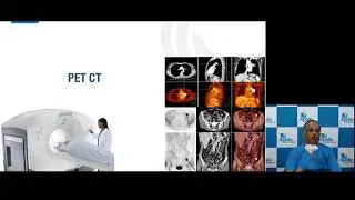 Advanced Therapy in Oncology Practice | Apollo Hospitals