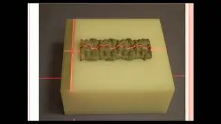 Aula sobre o exame de Densitometria Mineral Óssea - DMO