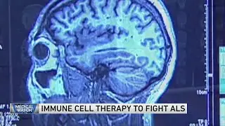 Immune cell therapy to fight ALS &mdash; and more