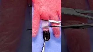 Practice Suturing on a Budget 😷🙌 #goodtoknow #surgeonlife #vet #medicine #funfacts #lifehacks