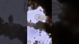 Worm vs. Stentor under the Microscope #microscope #biology