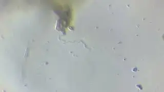 Spirochete