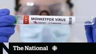 Experts urge awareness, not panic, over monkeypox