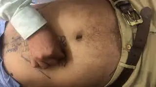 Japanese Abdominal Diagnosis  Dr Hemant Sharma
