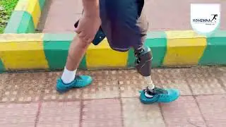 #ICONKNEEJOINT #ossurindia #abovekneeprosthesis #artificallimb #artificalleg #prosthesis #indias1st