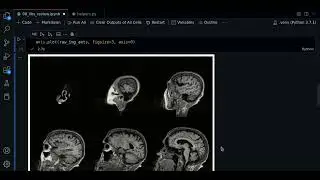 0.0 - ANTsPy review - Course MRI preprocessing with Python