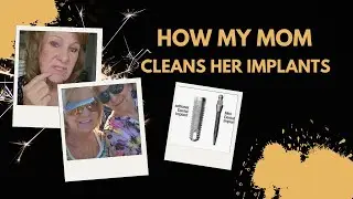 How To Clean Dental Implants / Mini Dental Implant /Traditional Dental Implant