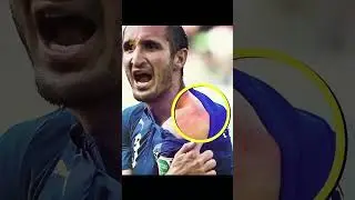 Suarez&rsquo;s Most Controversial Moments &ndash; The Bites That Shocked the World