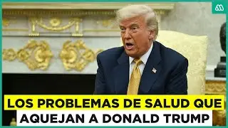 Insuficiencia venosa: Donald Trump reporta problemas de salud