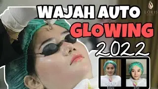 Wajah Cerah, Glowing Dan Kenyal Tanpa Ada Bekas 