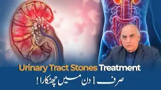 urinary tract stones