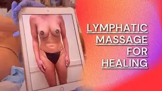 JUST A FEW DAYS AFTER SUPERMODEL LIPO GETTING LYMPHATIC MASSAGE FOR HEALING | Dr. JASON EMER