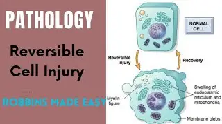 Reversible Cell Injury for NEXT Exam | General Pathology by Anish Vadhel | Robbins Made Easy