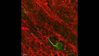 3D Airyscan image of Nav1.6 knock-in neurons