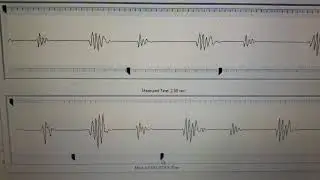 Another change on the Heart Sound Recorder.