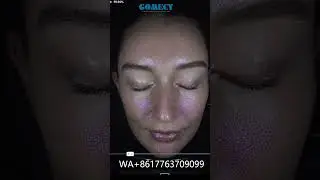 GOMECY Facial skin analyzer