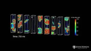 Computer Model Sheds Light on Biological Events Leading to Sudden Cardiac Death