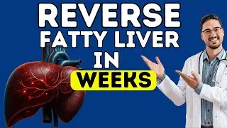 The FASTEST Way to Reverse Fatty Liver | NAFLD Treatment | Reverse Fatty Liver FAST! | Health Tips