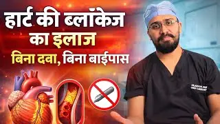EECP - myths vs facts??