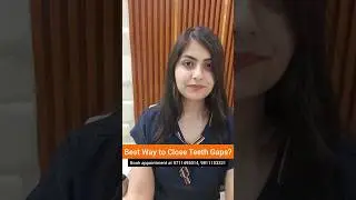 Best Way to Close Teeth Gaps WITHOUT Braces? Dr. Srishti Bhatia #gapaligner #teethgapmakeover